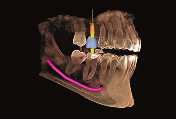Cone Beam 3D
