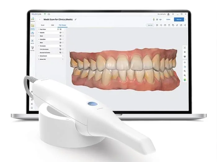 Empreinte numérique 3D