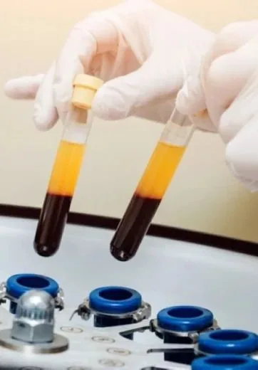 PRF centrifugation – Cabinet KEO